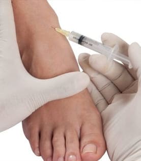 Procedimientos ortopédicos de pies y tobillos