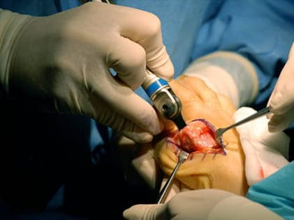 Ortopedia cirugía